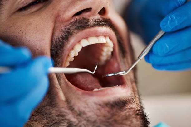 Best Dental Abscess Treatment in Montpelier, ID