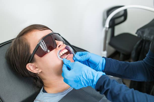 Best Knocked-Out Tooth (Avulsed Tooth) Treatment in Montpelier, ID