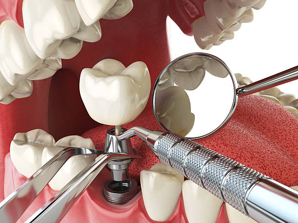 Best Emergency Cosmetic Dentistry (e.g., broken veneers) in Montpelier, ID