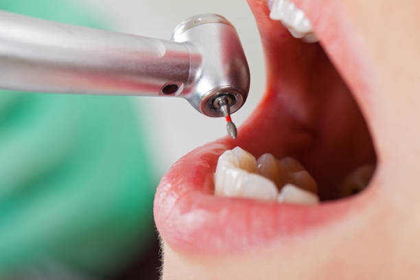 Best Emergency Treatment for Jaw Pain or Injury in Montpelier, ID
